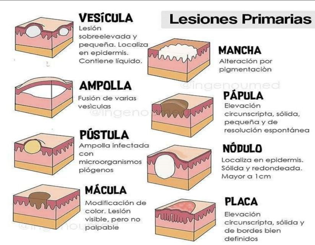 lesiones